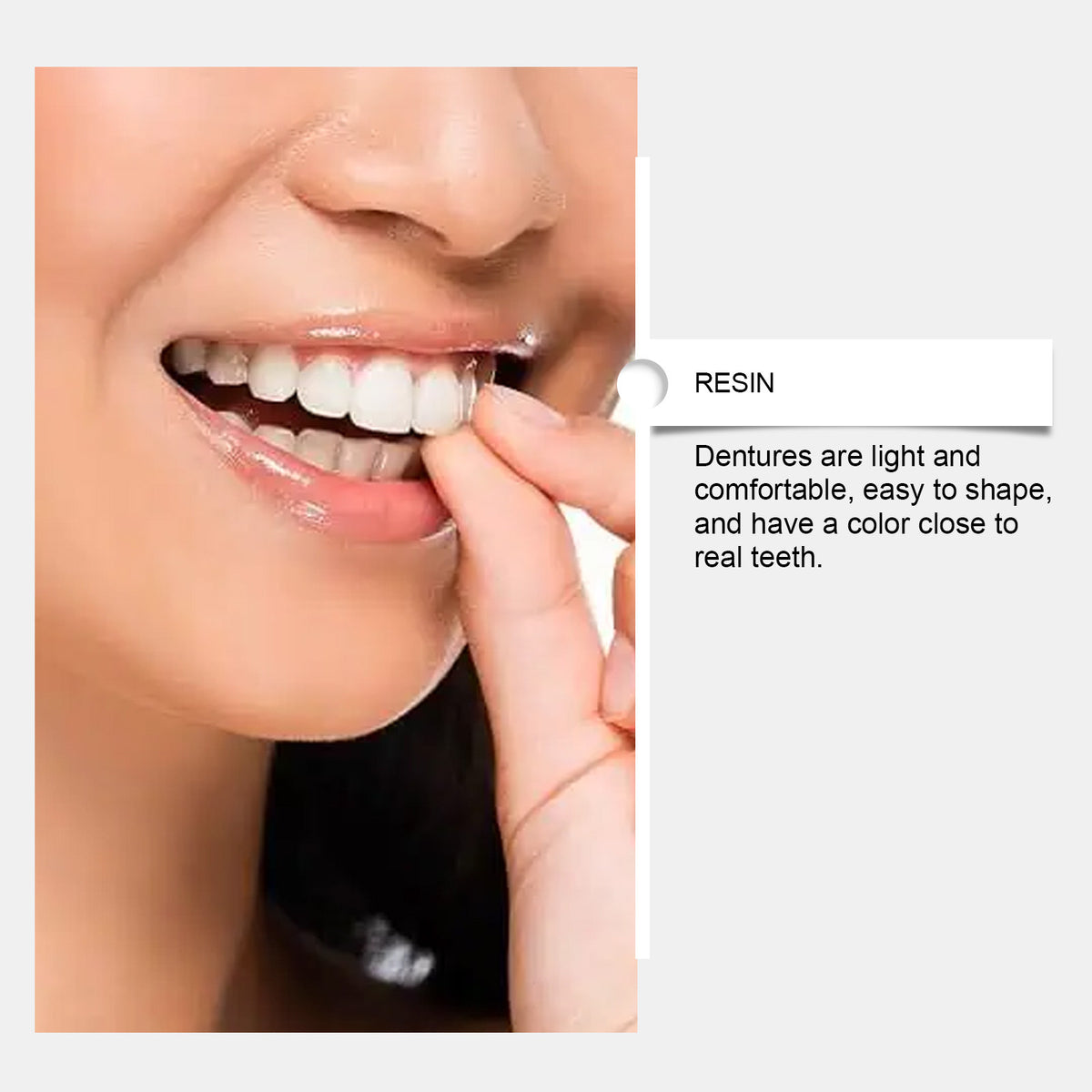 Dental prosthesis accessory set